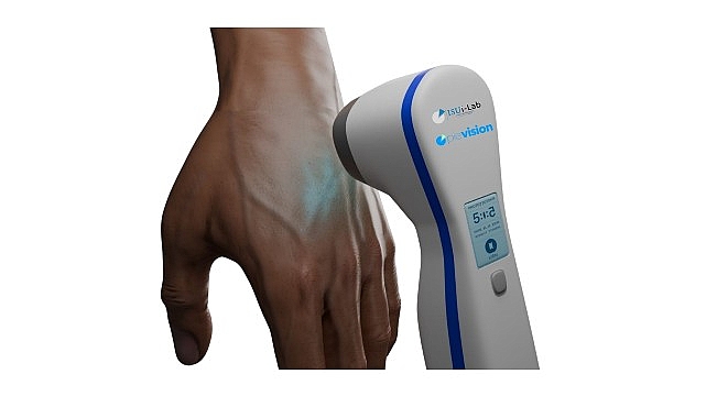 Üniversite öğrencisi babasının hastalığından yola çıkarak vitiligo tedavisi için cihaz geliştirdi